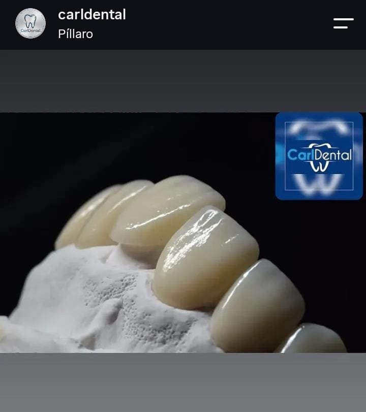 CARLDENTAL en Píllaro (Matriz), Píllaro (1)